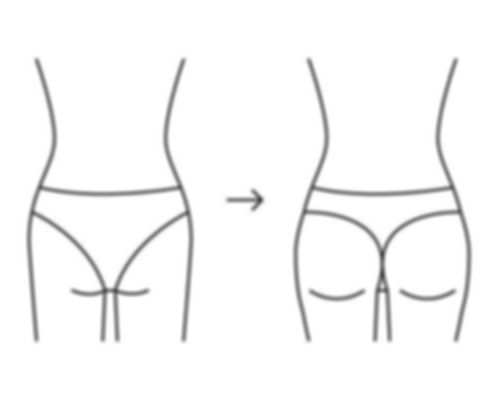 types-of-butt-woman-shape-buttock-back-line-icon-augmentation-reshape-buttocks-from-small-